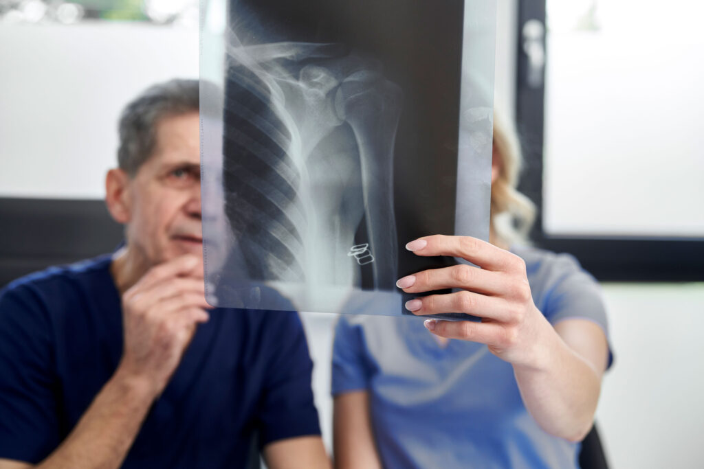 Shoulder img 03 20250602