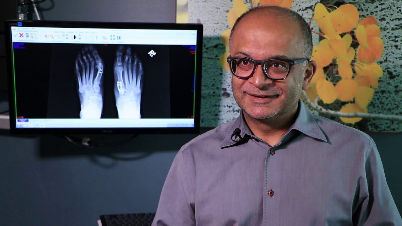 Dr desai explains lapiplasty a new way to correct bunions