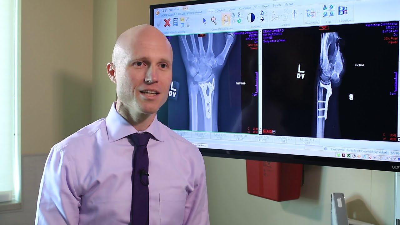 Learning about a broken wrist and understanding the recovery