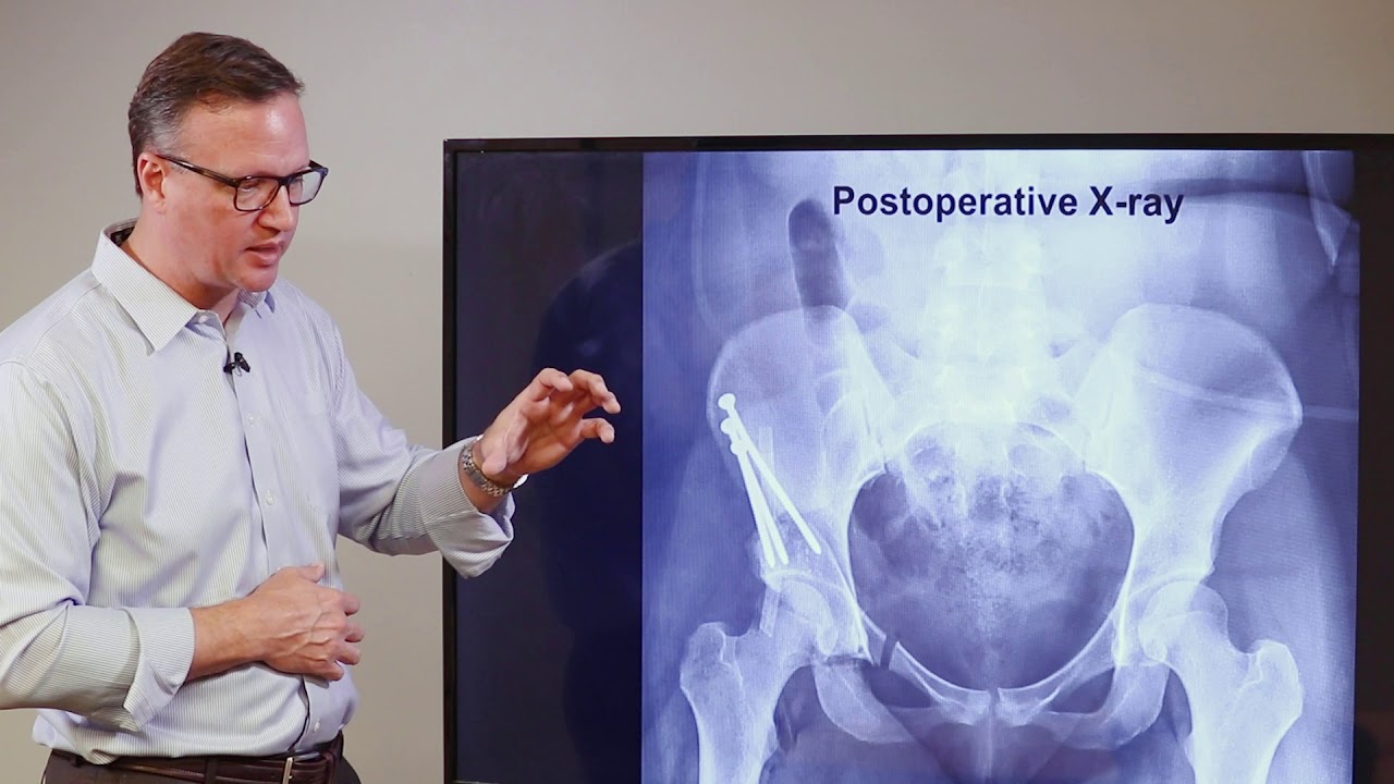 Dr. Ronald hugate, md explaining what to expect from ganz osteotomy surgery while showing a postoperative x-ray.